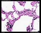 clostridium perfringens